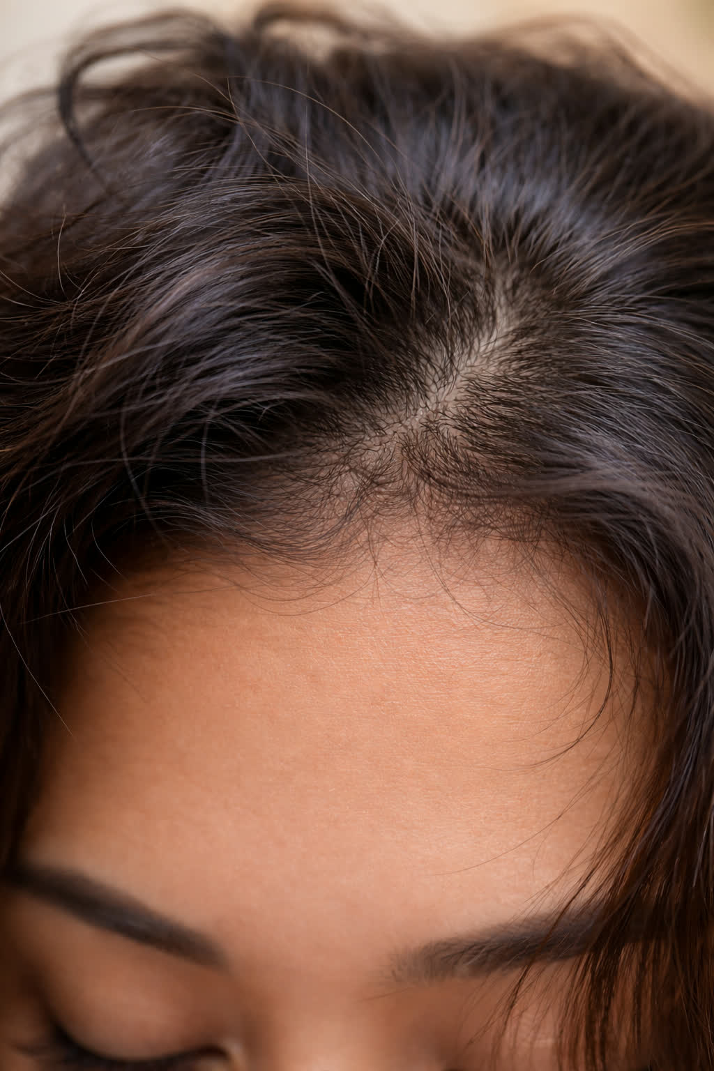 Baby hairs — new growth