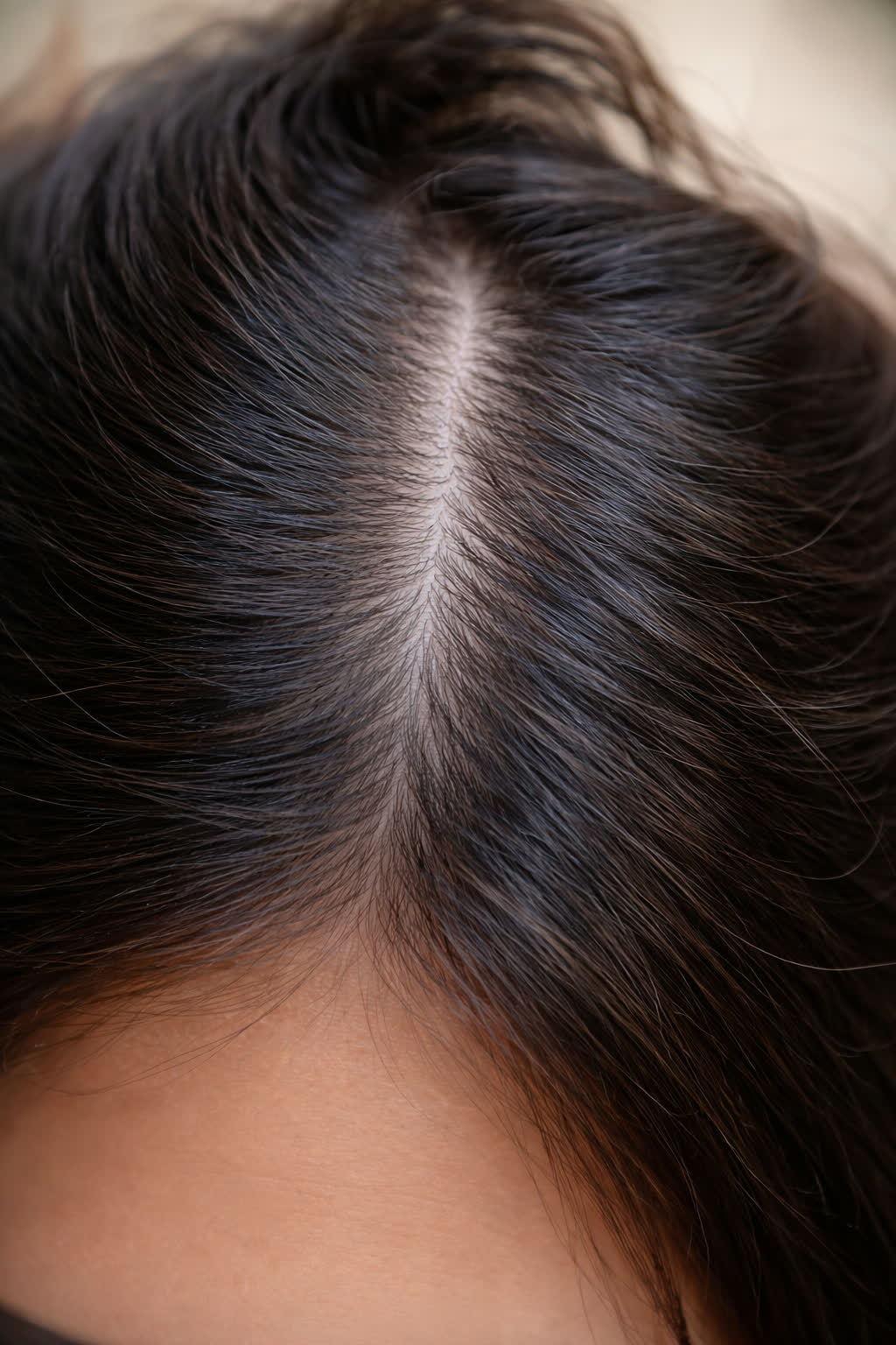 Clean scalp — defined part